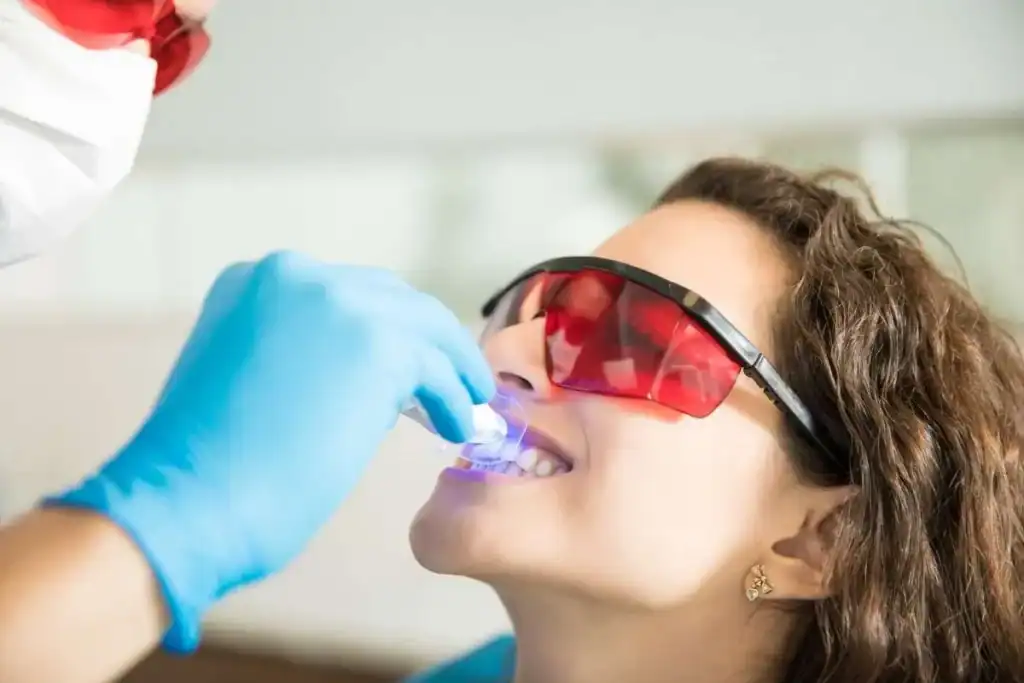 Laser Teeth Whitening FAQs Kettering &ndash; Your Ultimate Guide Kettering